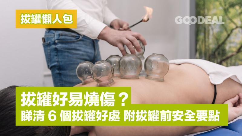 拔罐懶人包｜拔罐好易燒傷？睇清6個拔罐好處 附拔罐前安全要點