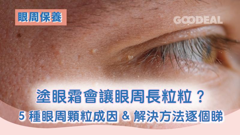 眼周保養｜塗眼霜會讓眼周長出粒粒？ 5種眼周顆粒成因&解決方法逐個睇